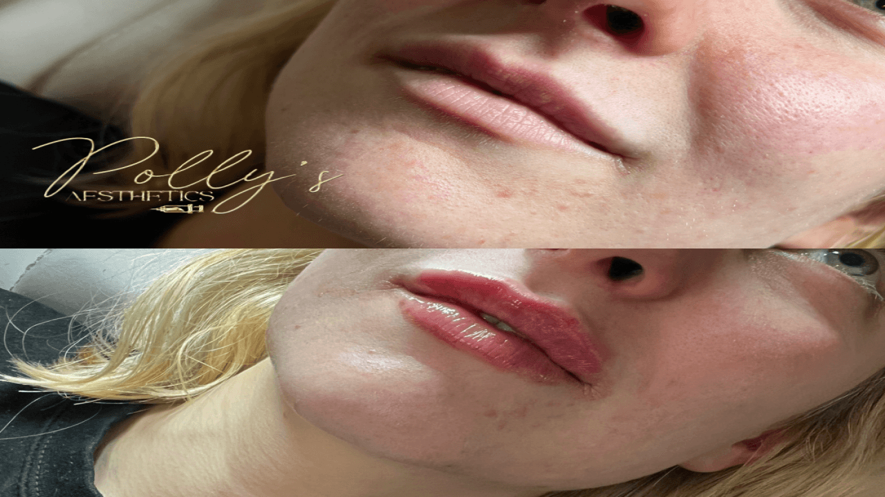 Pollys Aesthetics image 3