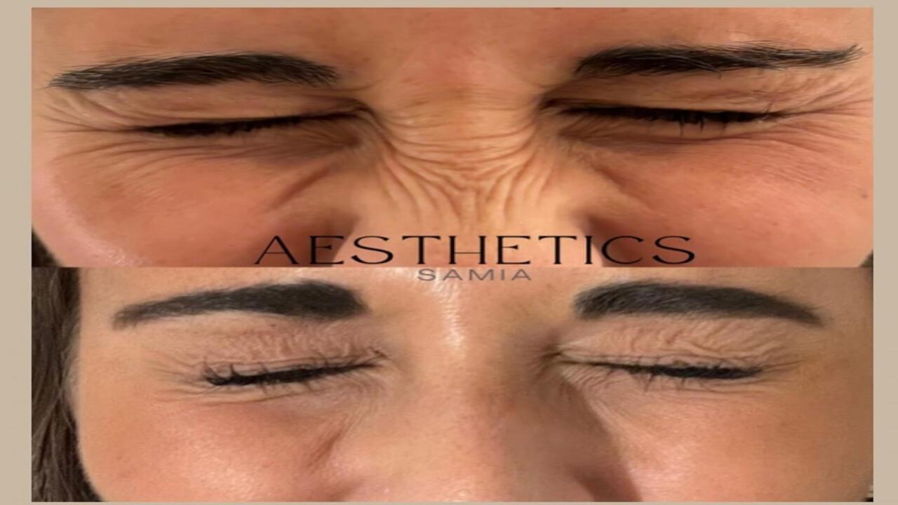 Aesthetics Samia image 3