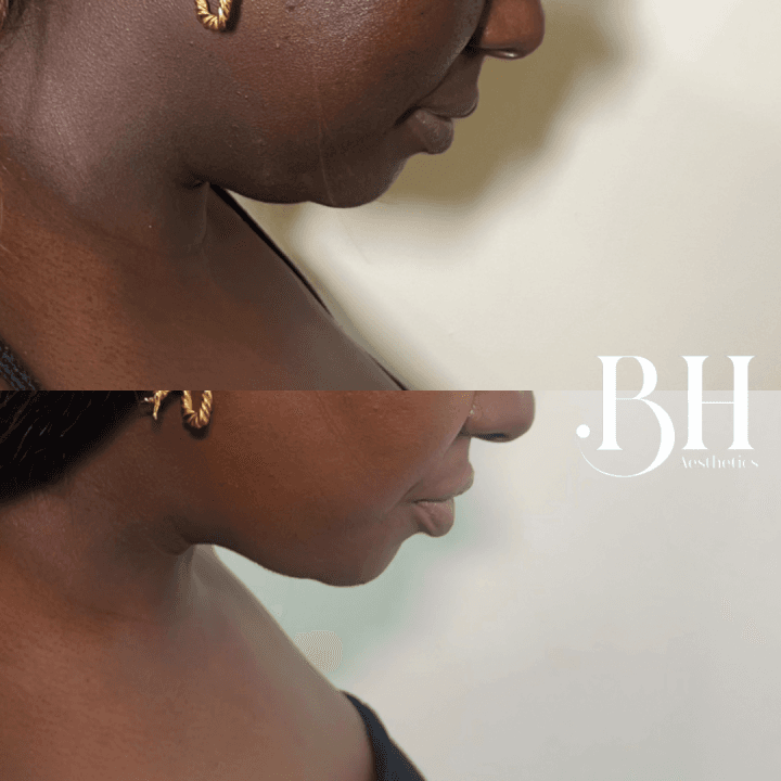 BH Aesthetics Stockwell image 2