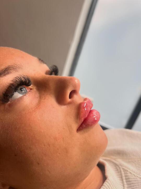 AMS Aesthetics image 2