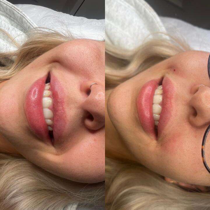 AngelAestheticsNCL image 1