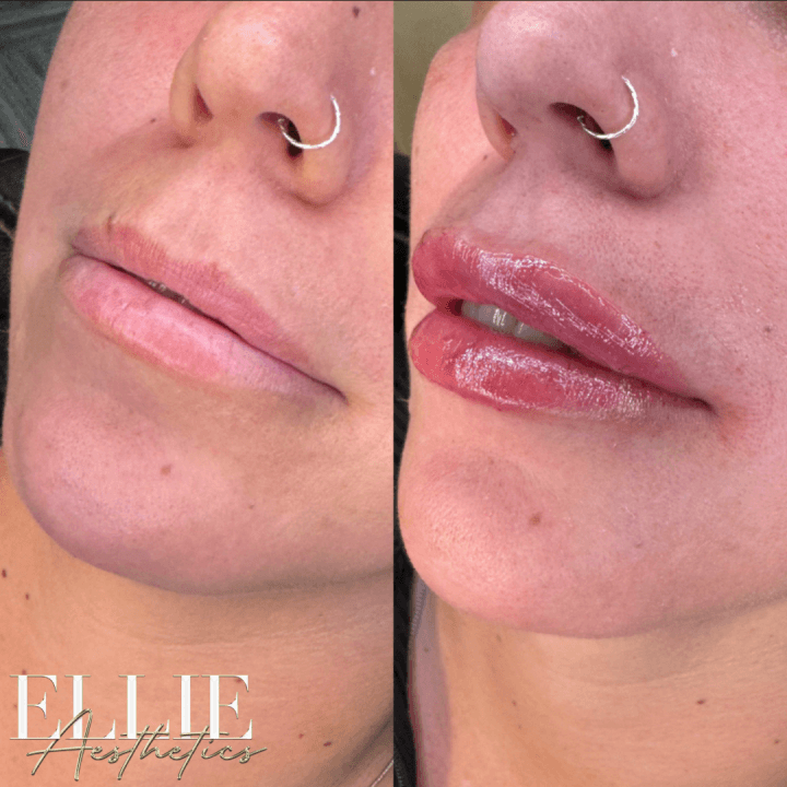 Ellie Aesthetics image 2