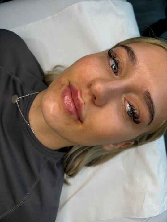 HM aesthetics image 3