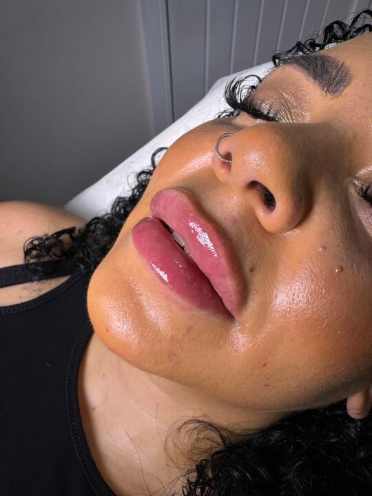 Exhale Therapy image 1