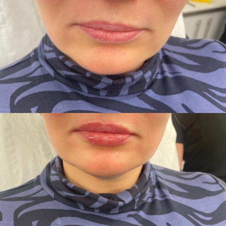 Bella beauty Skegness image 1