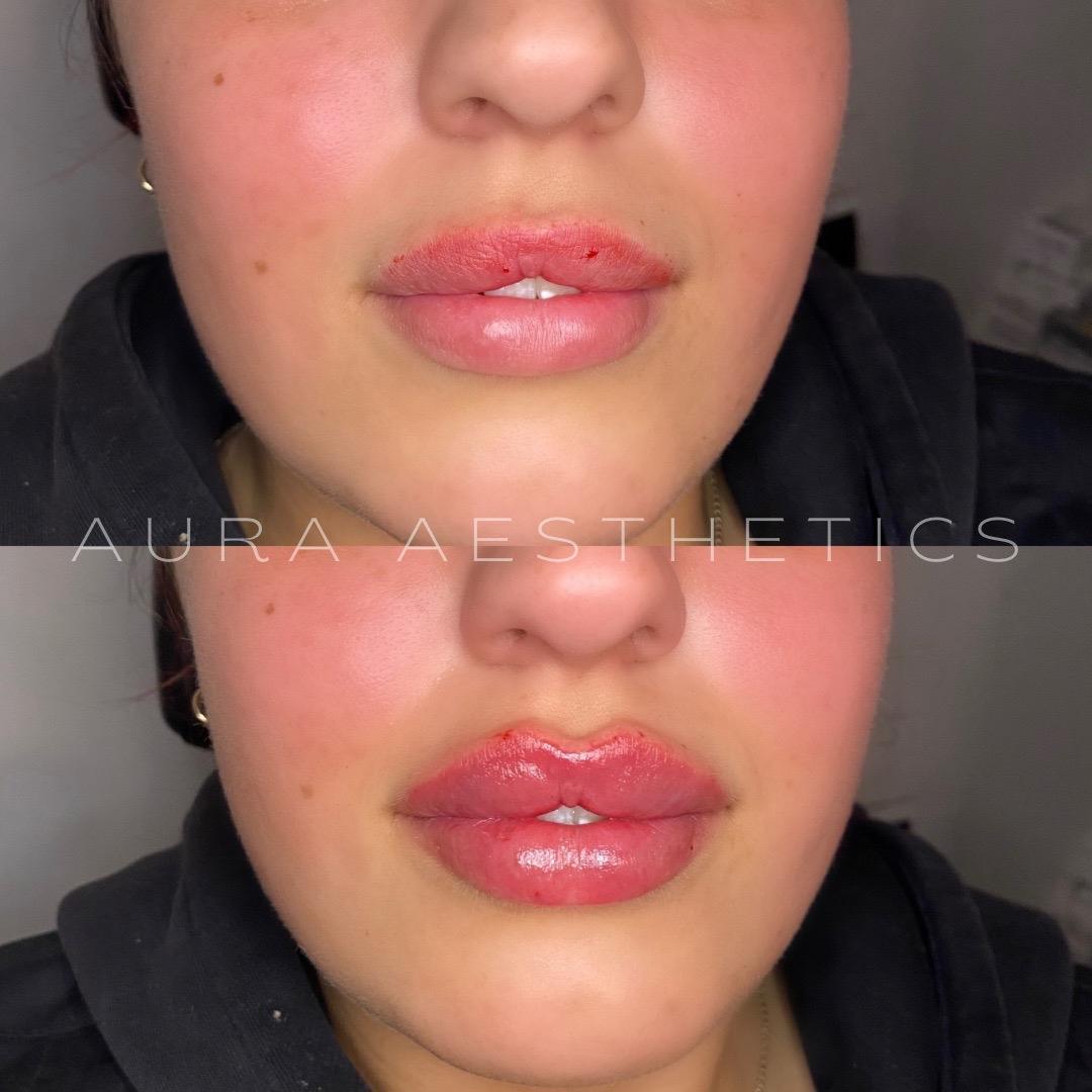AURA Aesthetics image 2