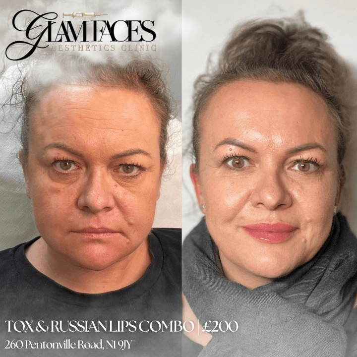 GLAM FACES AESTHETICS CLINIC image 3