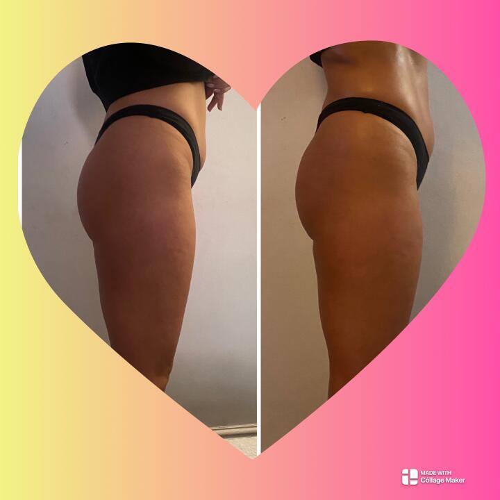 Brazilian Beauty - Body Contouring Specialist image 2