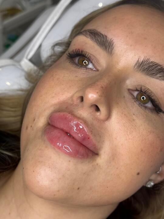 Pout and lash clinic image 3