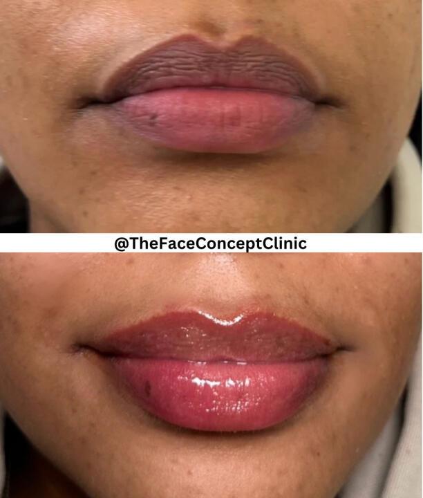The Face Concept Clinic image 3