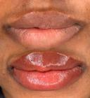 LIPBLUSHLDN