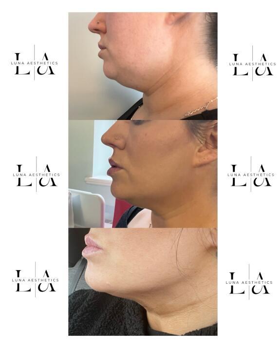 Luna Aesthetics at Glammed Beauty image 2