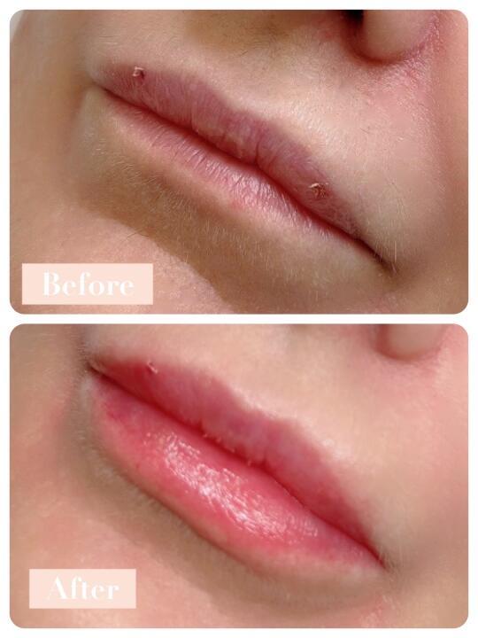 Luna Aesthetics at Glammed Beauty image 3