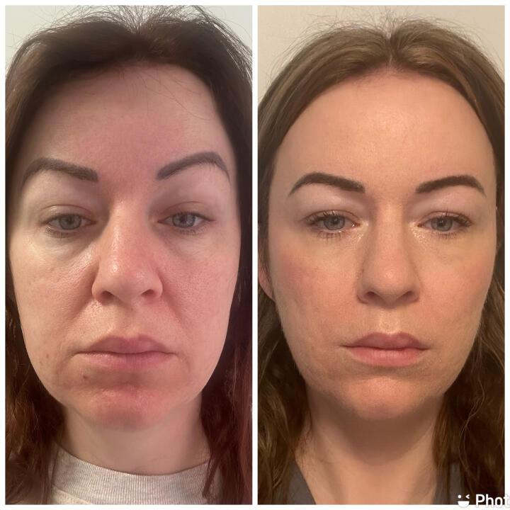 RN Aesthetics and Skin Rejuvenation image 3