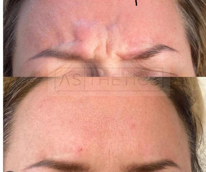 Beativu image 3