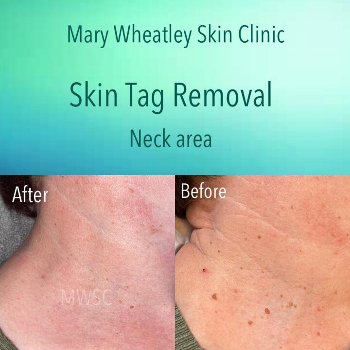 Mary Wheatley Skin Clinic image 3