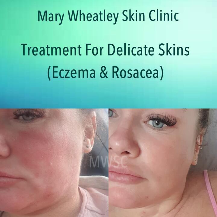 Mary Wheatley Skin Clinic image 2