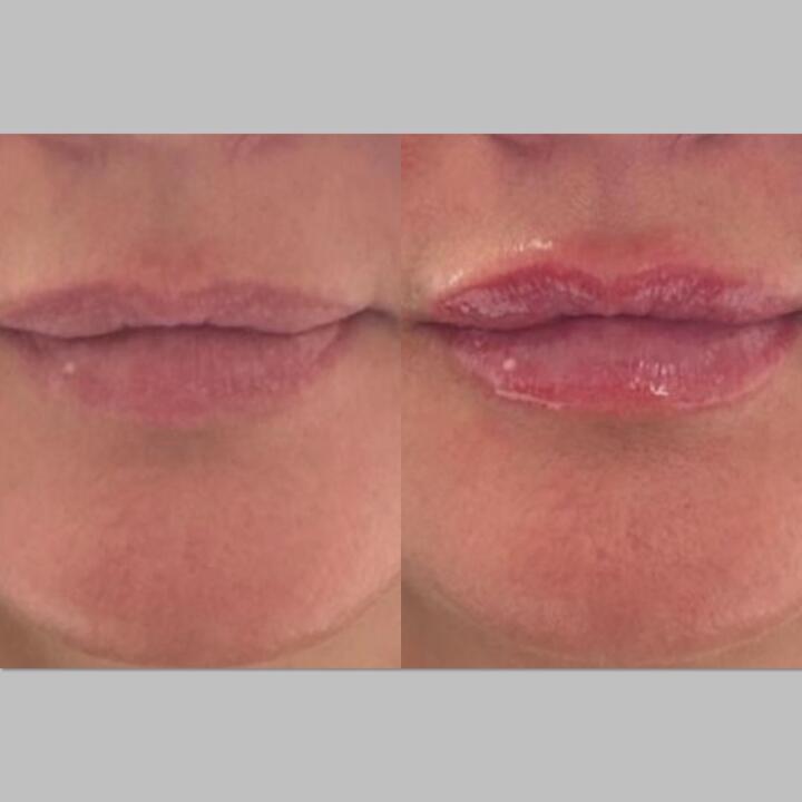 Leah Thompson Aesthetics image 2