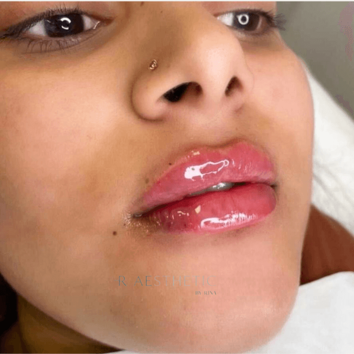 R Aesthetic Clinic image 2