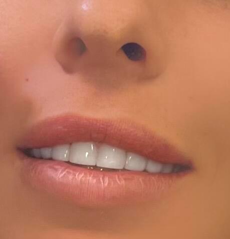 LiyaRei Aesthetics image 3