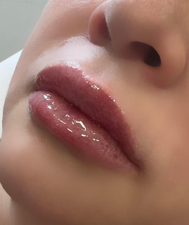 LiyaRei Aesthetics image 1