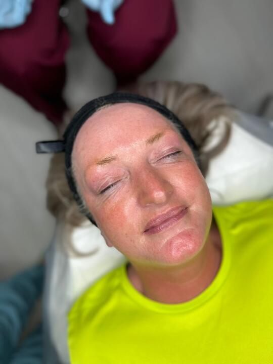 Face Aesthetics image 2