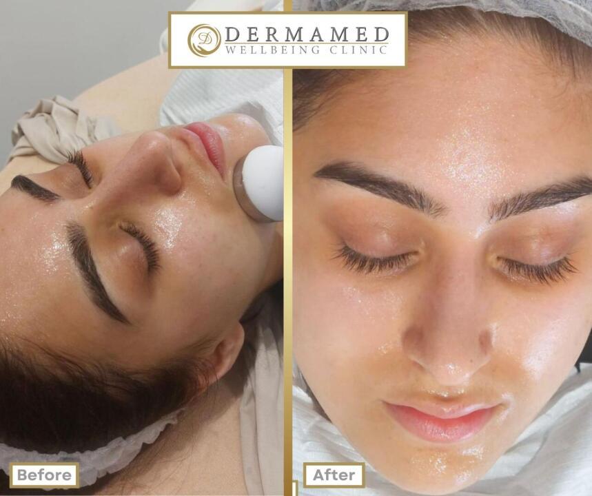 Dermamed Wellbeing Clinic image 3