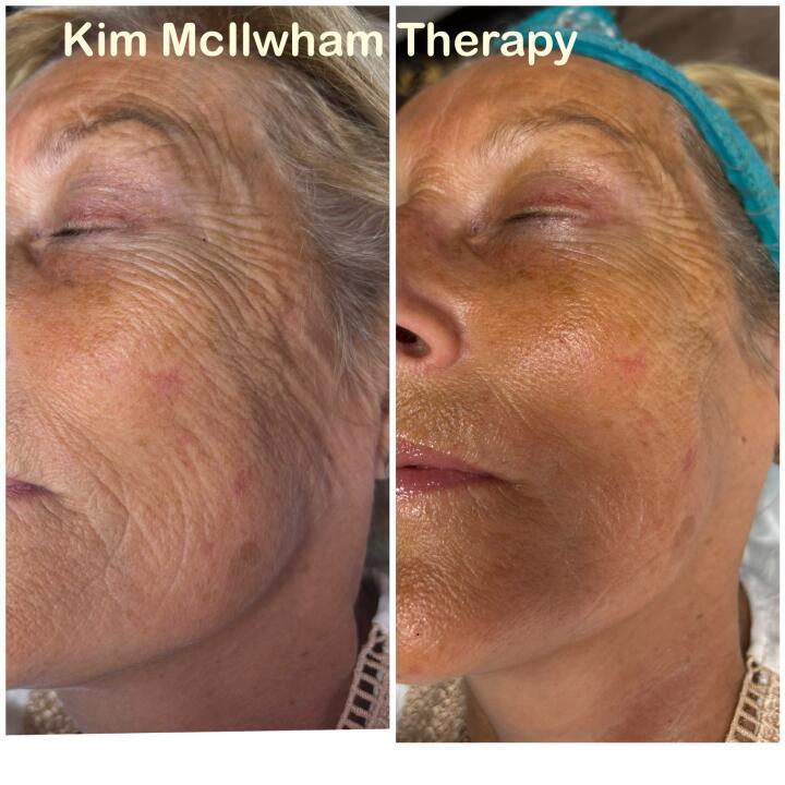 Kim McIlwham Therapy image 3