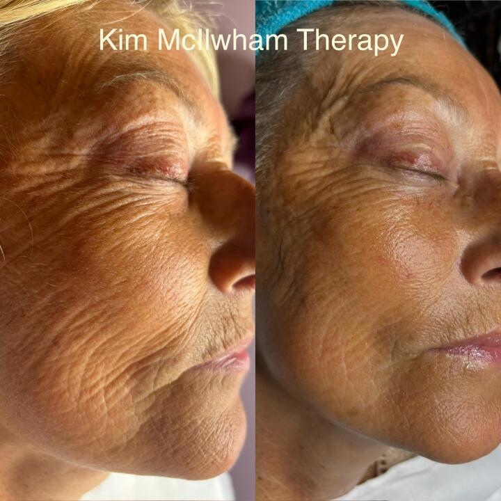 Kim McIlwham Therapy image 2