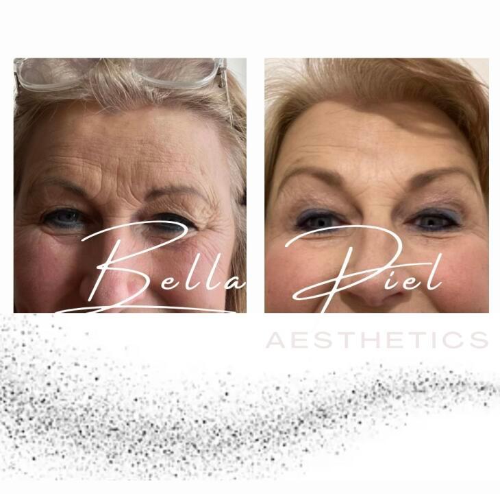 Bella Piel  image 3