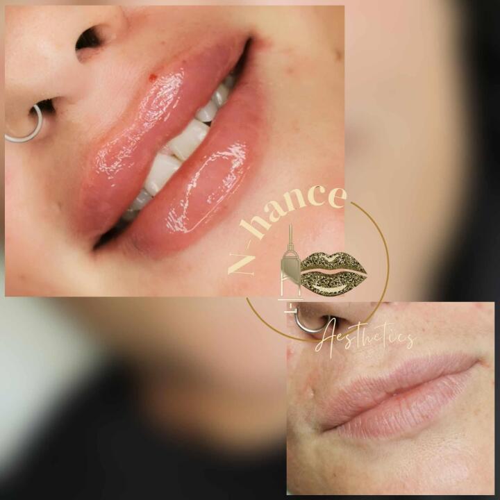 Nhance Aesthetics image 3
