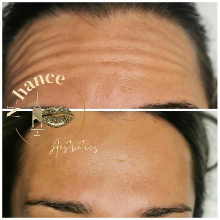 Nhance Aesthetics image 2