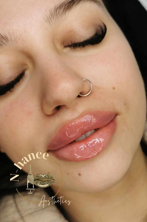 Nhance Aesthetics image 1