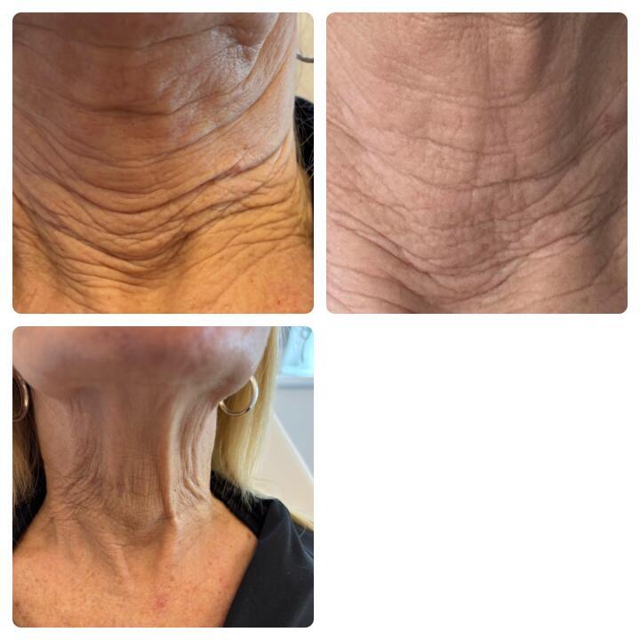 Primrose Aesthetics Wivenhoe image 1