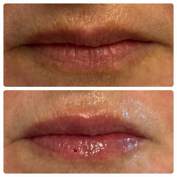 Primrose Aesthetics Wivenhoe image 2
