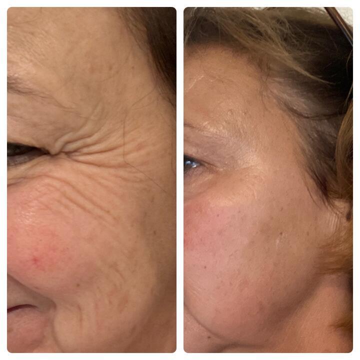 Primrose Aesthetics Wivenhoe image 3