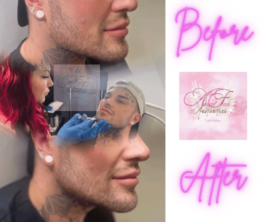 AngelFace aesthetics image 1