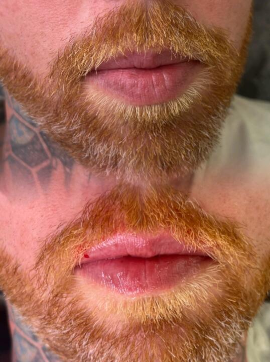 AngelFace aesthetics image 3