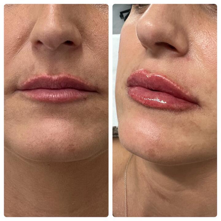 LF BEAUTY image 1