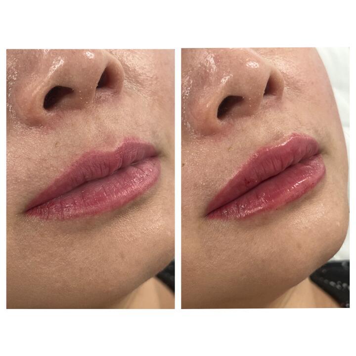 LF BEAUTY image 3