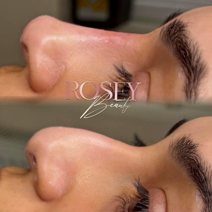 ROSEY BEAUTY HQ image 3