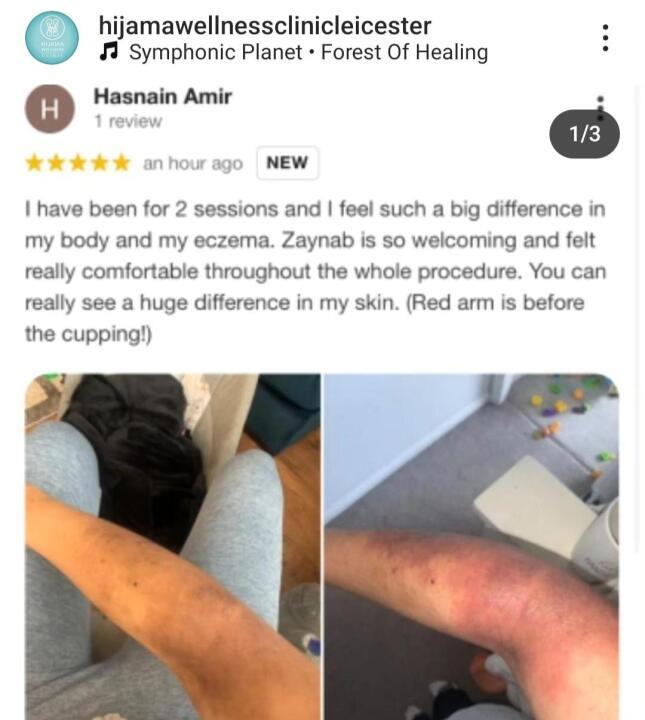 Hijama wellness clinic image 3