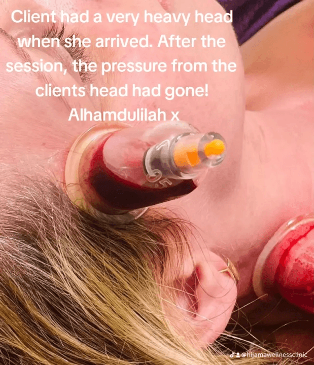 Hijama wellness clinic image 2