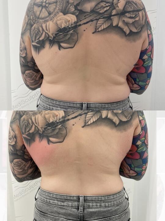 MediSculpt Pro image 2