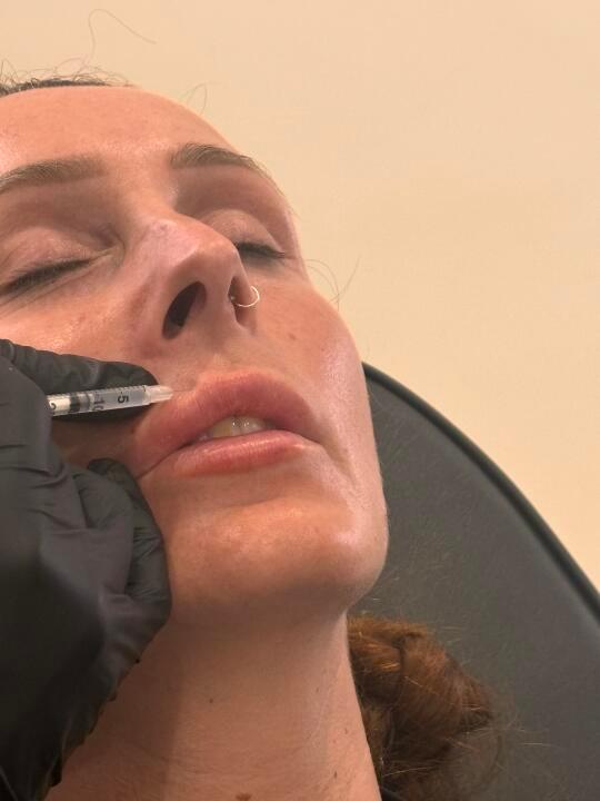 Skinfinity image 2