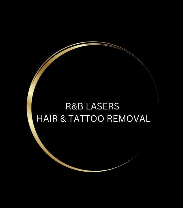 RnB Lasers - Cumbernauld image 1