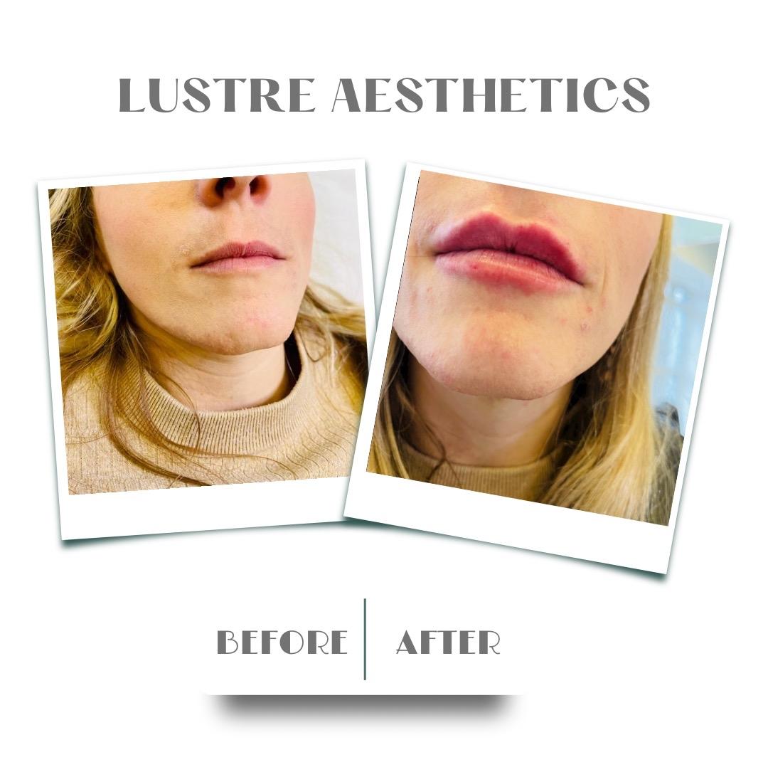 Lustre Aesthetics Clinic image 2