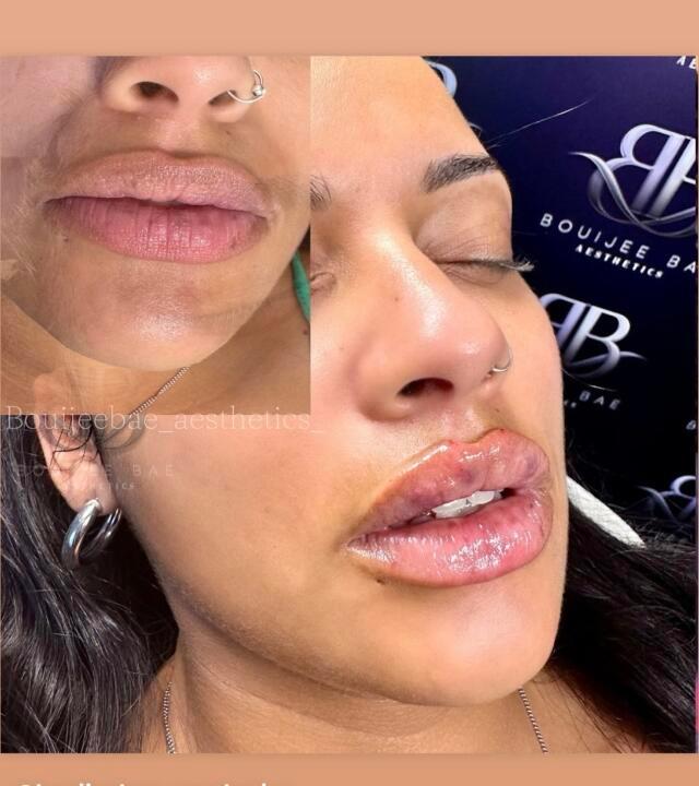 BouijeeBae Aesthetics image 2