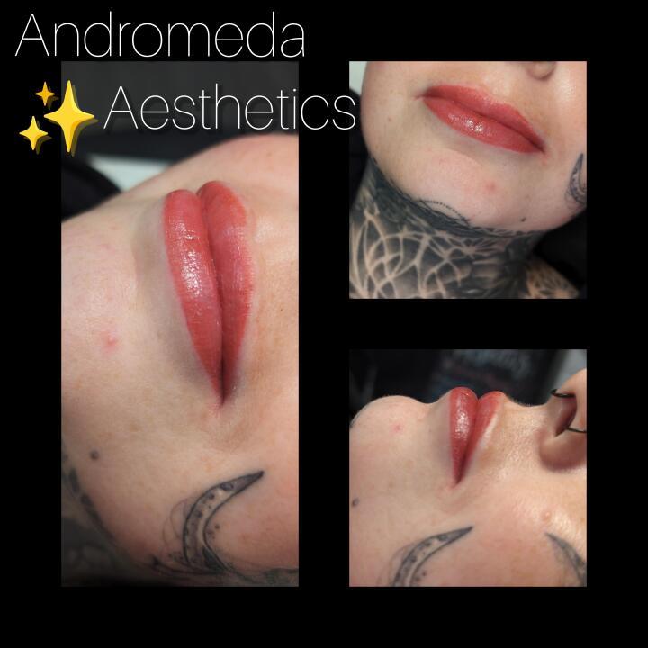 Andromeda Aesthetics image 1