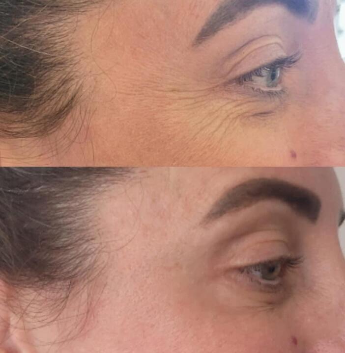 Porscher aesthetics image 3